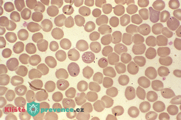 babesia v krvi